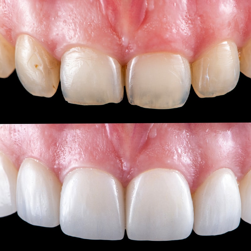 Full mouth 3 new 800